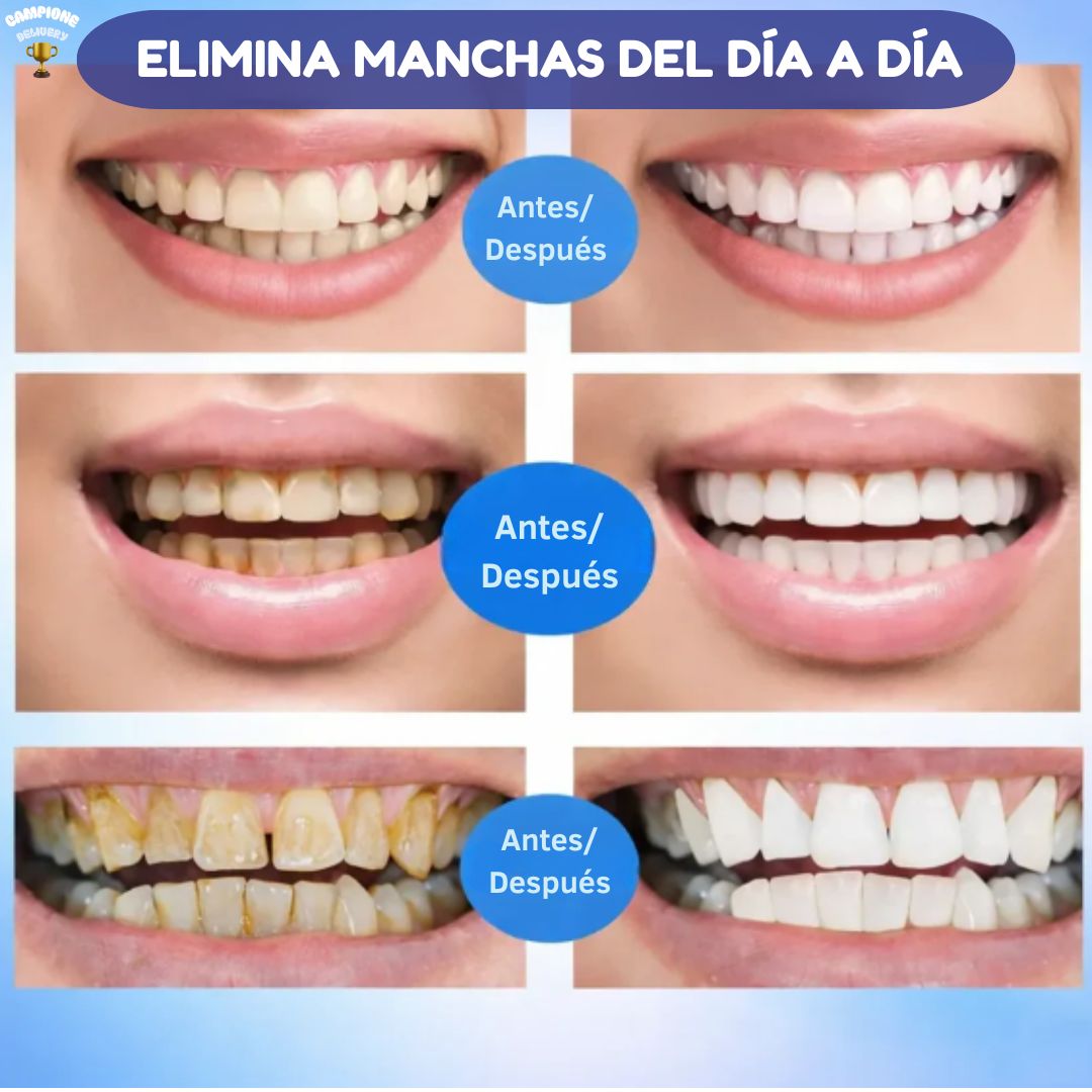 Dazzling White® - Reduce manchas y mejora tu sonrisa